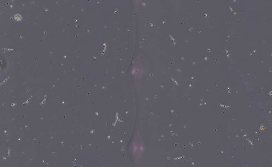 【参考写真1】実際に検査を行っている貯水池や河川等の試料